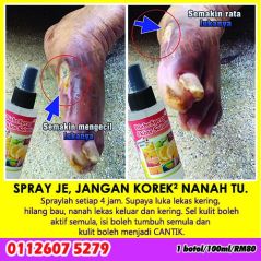 AzfaRich DiabeSpray Skin Solution - Diabetes Renew Skin Spray, Spray luka kencing manis 100ml